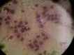 Oncolog�a