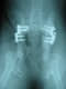 Traumatolog�a
