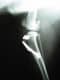 Traumatolog�a
