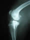 Traumatolog�a