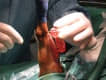 Traumatolog�a