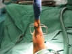 Traumatolog�a