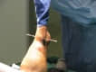 Traumatolog�a