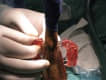Traumatolog�a