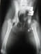 Traumatolog�a